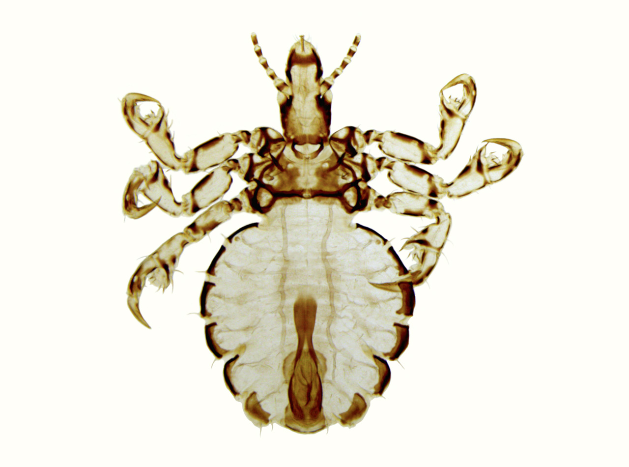 Haematopinus suis